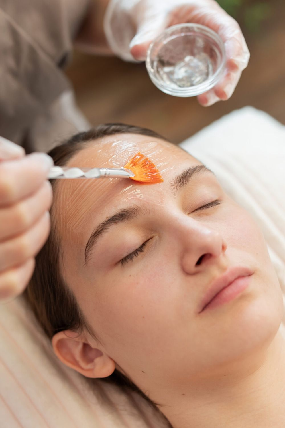 Chemical Peels at MiST